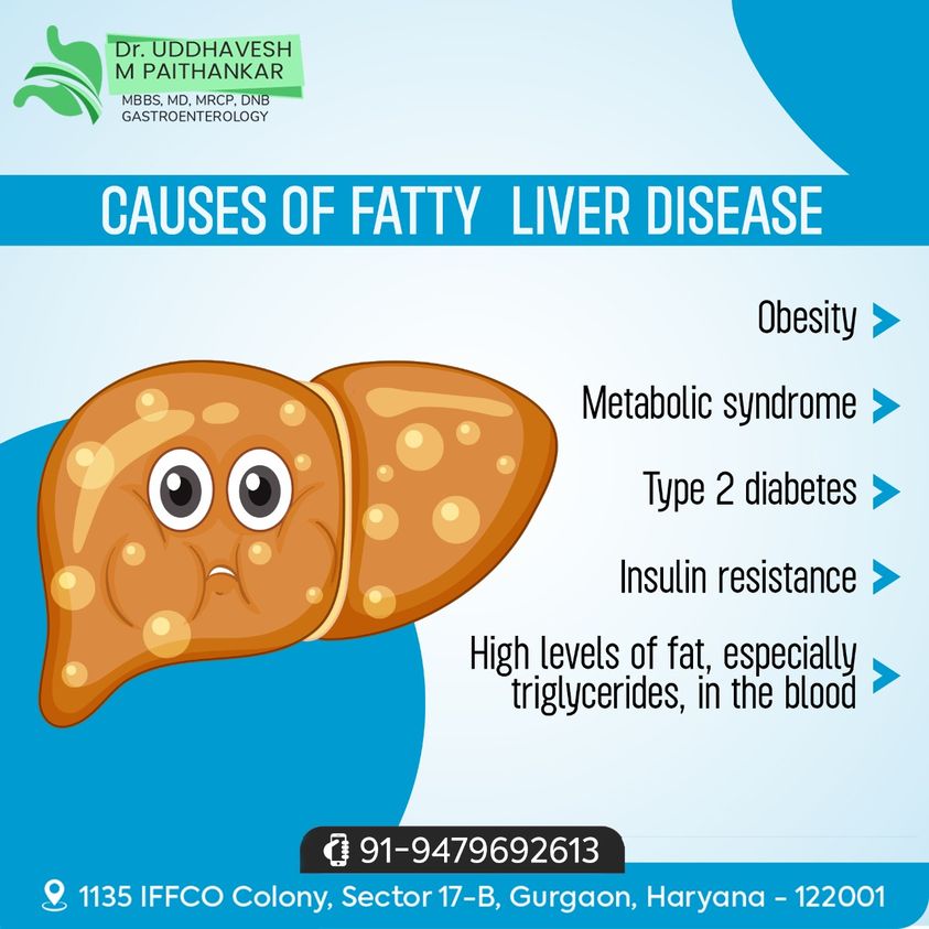  NCR Gastro Liver Clinic in Gurgaon-15
